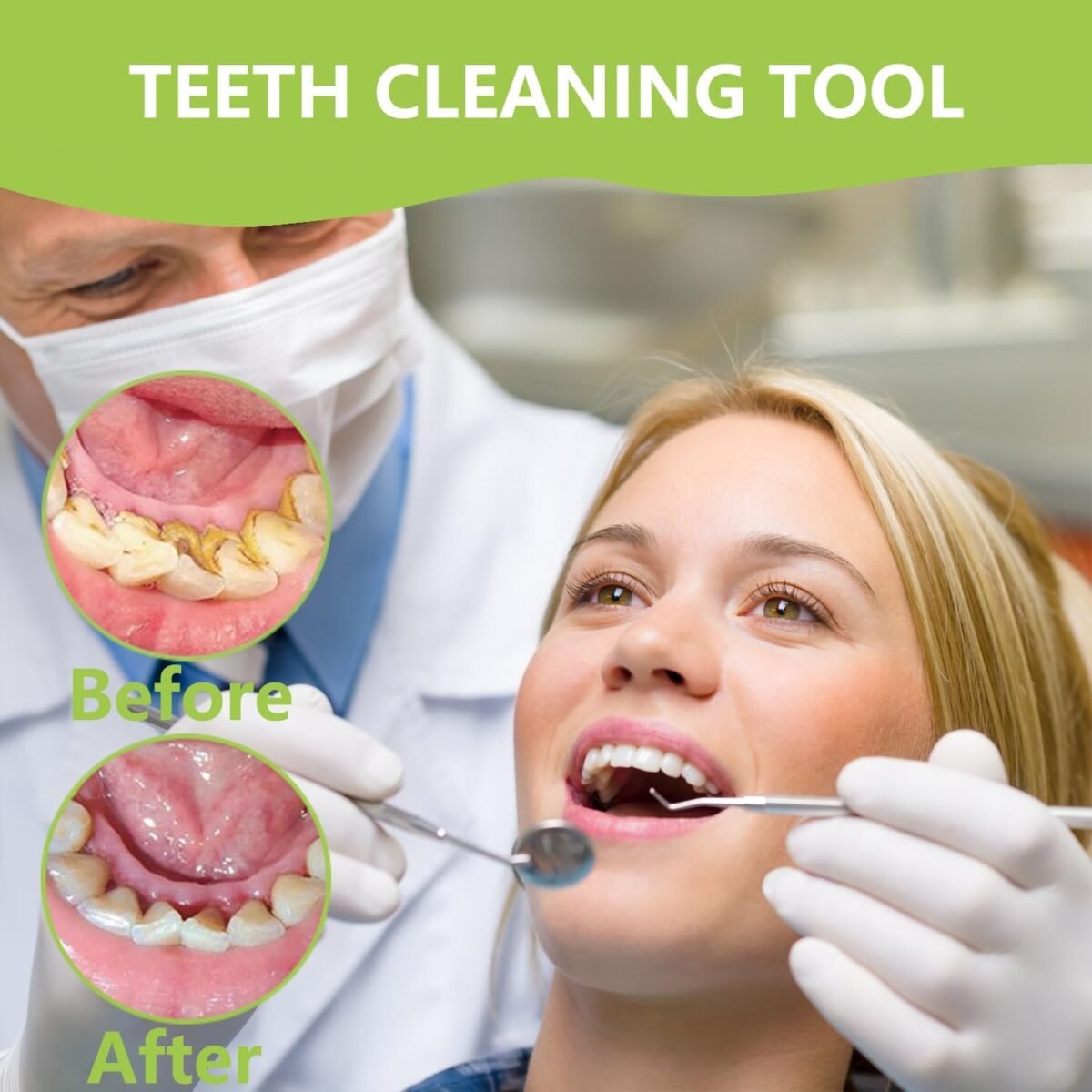 1746785062 dental tools professional teeth cleaning oral care hygiene kit stain.jpg
