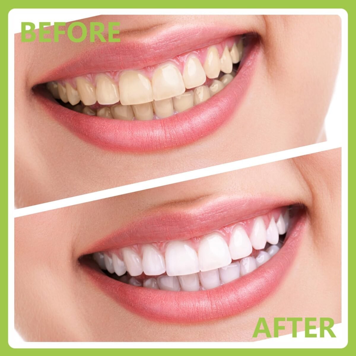 1746785068 dental tools professional teeth cleaning oral care hygiene kit stain.jpg