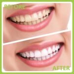 1746785068 dental tools professional teeth cleaning oral care hygiene kit stain.jpg