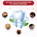 1753311538 2pcs sp10 probiotic toothpaste super probiotic deep cleaning care fre.jpg