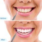 1758245130 patelai 100 pieces braces brush for cleaner interdental brush toothpic.jpg